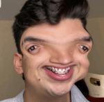 Ale~