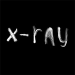 X-rayss