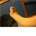 Brandon's foot