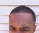 fybjmanehairline