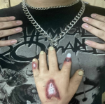 4xnormal