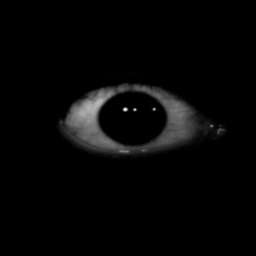 Agoraphobia