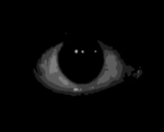 The group of the eye