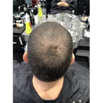 thinning