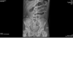 BackBoneCrax
