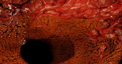 Free material Yellow Flesh - Mystery flesh pit preview 1