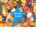 Gummy smile