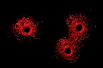 Wound ⋆