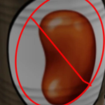 The Re-Formed Federation of the Anti-Bean Society.