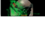 Valve Issue ##########