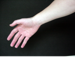 right arm right