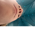 siclepop