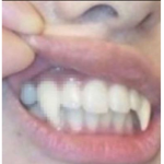VAMP1R3S