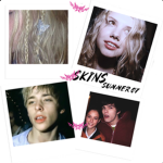 SKINS εïз