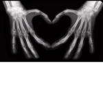 Alt loves
