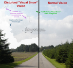 Visual Snow Syndrome (VSS)