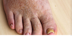 -Toe nail eaters-