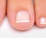 Toe nails Abuse