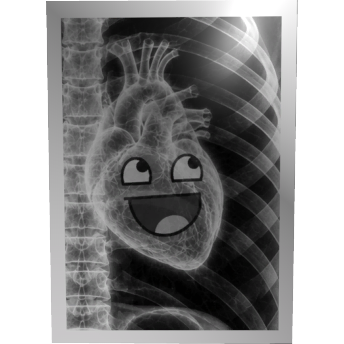 Epic Face Heart X-ray