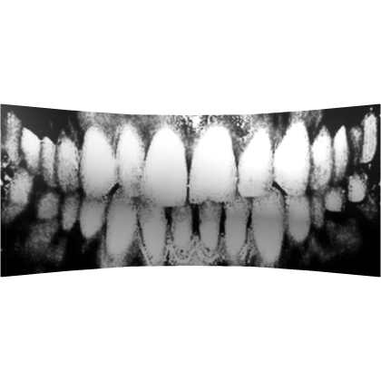 Creepy Black Teeth Mouth Cover