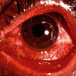TheNaglePackage
