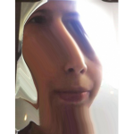 monogus