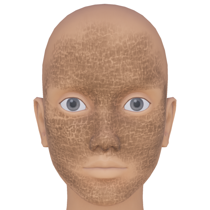 Cracked Skin Texture