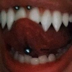gross lol