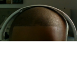My hairline