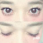 poside