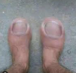 Funny toes