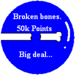 Broken bones.