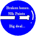 Broken bones.