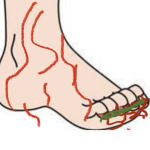 Toe curling cult