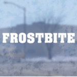 Frostbitе