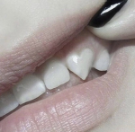 teefy