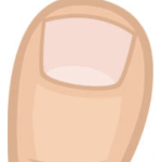 ### ## #### #### toes Toes