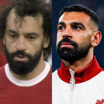 Turkish Hairlines