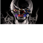 Crood$