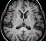Gray Matter