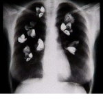 +. butterflies Ϟ .