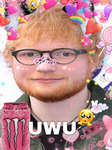 ed sheerans toe