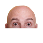Assosiação Anti Careca