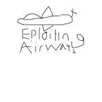 EPLOITING