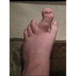 Smelly Fat Toes