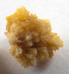 tonsil stones