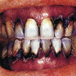 mouth rot Group Thumbnail