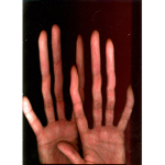 Long Fingers