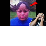 your hairline is dodo