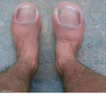Toe_Ticklers